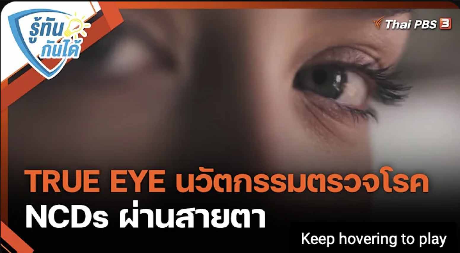 True Eye